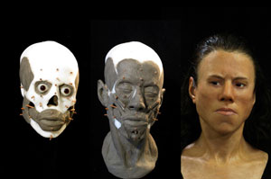 بازسازی چهره